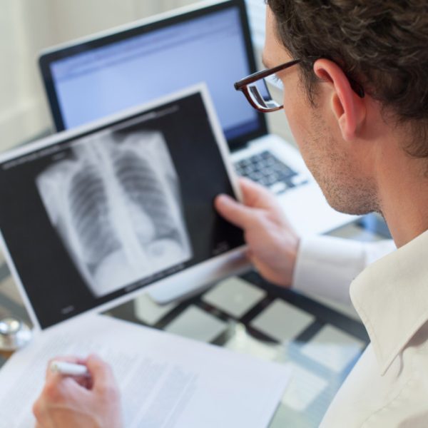 A doctor examining a lung x-ray result
