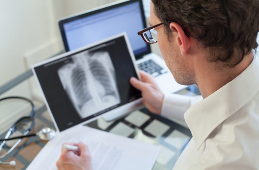 A doctor examining a lung x-ray result